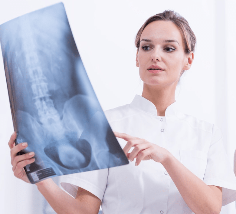 Diagnose der thorakalen Osteochondrose durch Röntgenuntersuchung